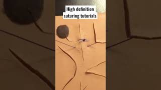 Simple interrupted suturing in HD 🩺 🏥