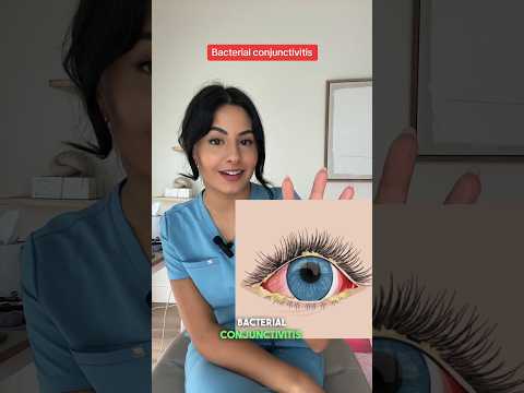 Doctor Explains why your eye is Red 👁️  🚨