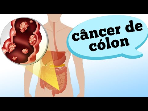 Cauze cancer la san