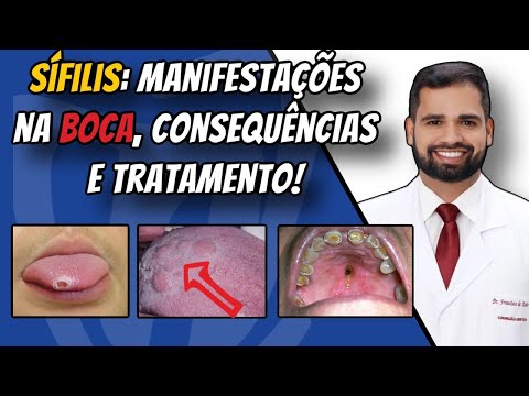 Francisco De Assis Almeida Lima Júnior-124