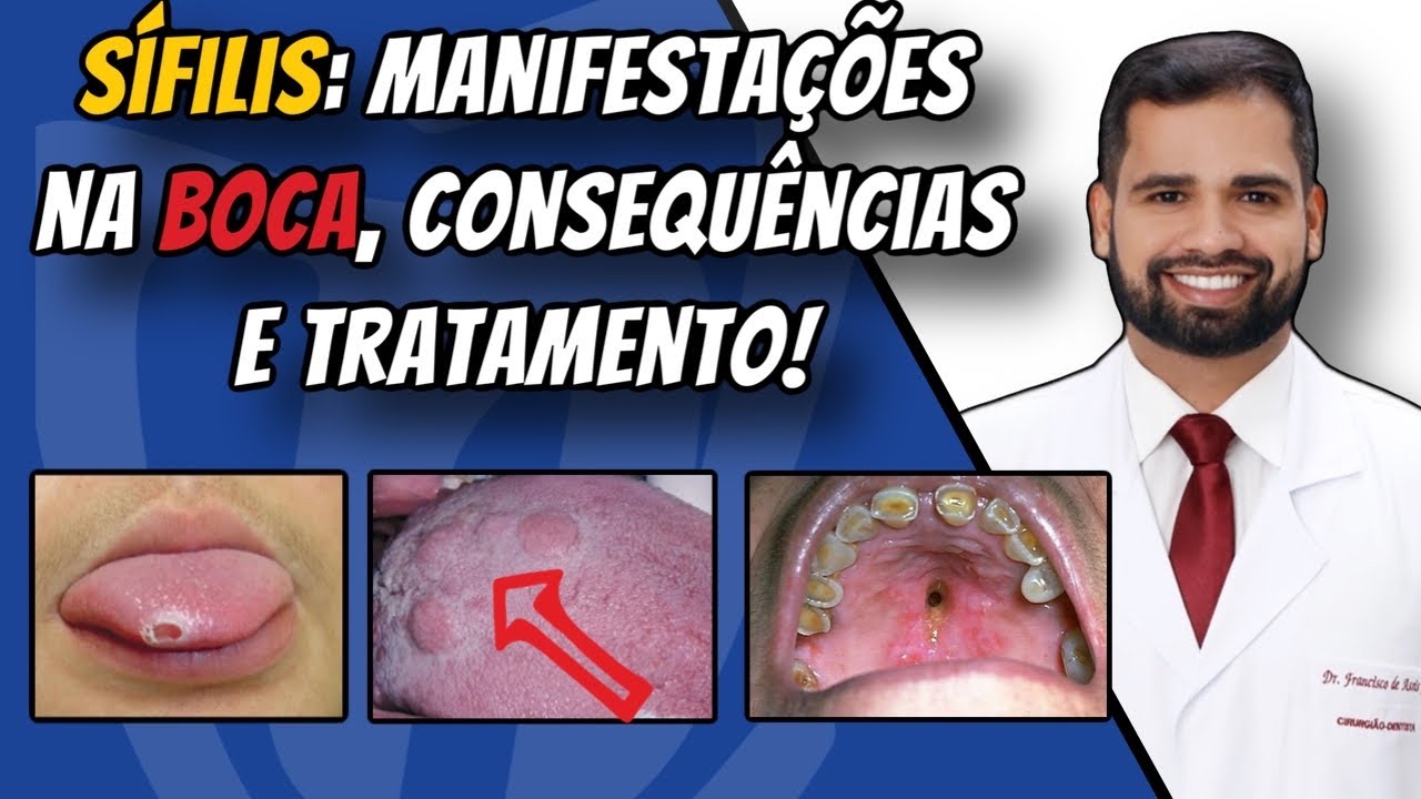 Francisco De Assis Almeida Lima Júnior-124