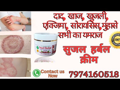 50g Herbal Anti Fungal Cream