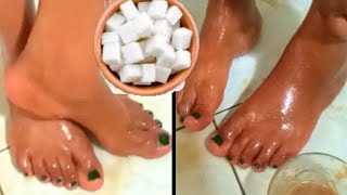 Use sugar naturally remove wrinkled feet remove cracked dry feet remove old legs