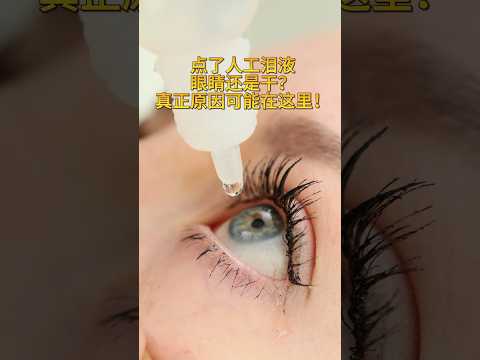 Optometry AI Digital Avatar Short — Dry Eye Relief