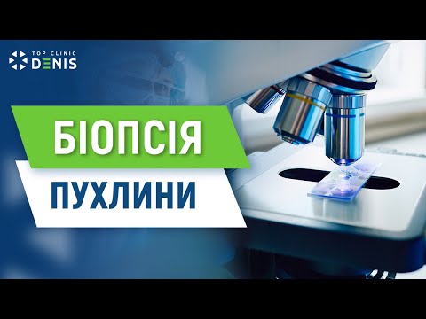 Биопсия опухоли с помощью КТ - TOP Clinic DENIS