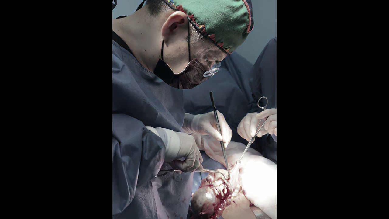 Ángel Millán Juárez-93