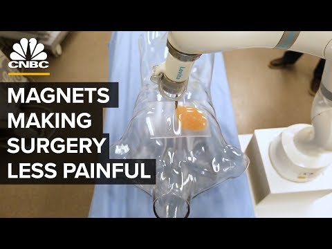 How Magnets Make Surgery Less Painful