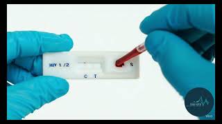 HOW TO Use an HIV Self-Test Kit at Home (Finger Prick Tutorial)
