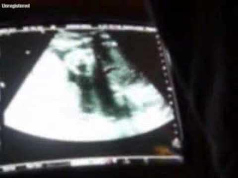 2006-10-23 Sonogram #1