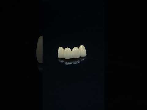 YouTube 썸네일