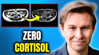 Download lagu This Will Get You to 0% Visceral Fat in 30 Days! (Drops Cortisol) | Dr. David Sinclair mp3