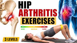 Hip Arthritis Exercises | Easy, Medium & Hard 
