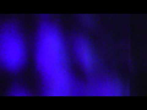 Anders Tveit: Ierotelestiá