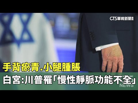 手背瘀青.小腿腫脹　白宮：川普罹「慢性靜脈功能不全」