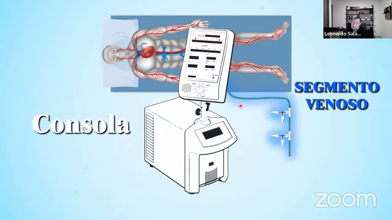 Abordaje estratégico de la canulación percutánea en ECMO, parte 1