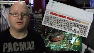 Tutorial: Battery Removal & Clean Up : Archimedes A3020/A3010