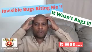 Invisible Bugs Biting me (it wasn&#39;t bugs!!!)