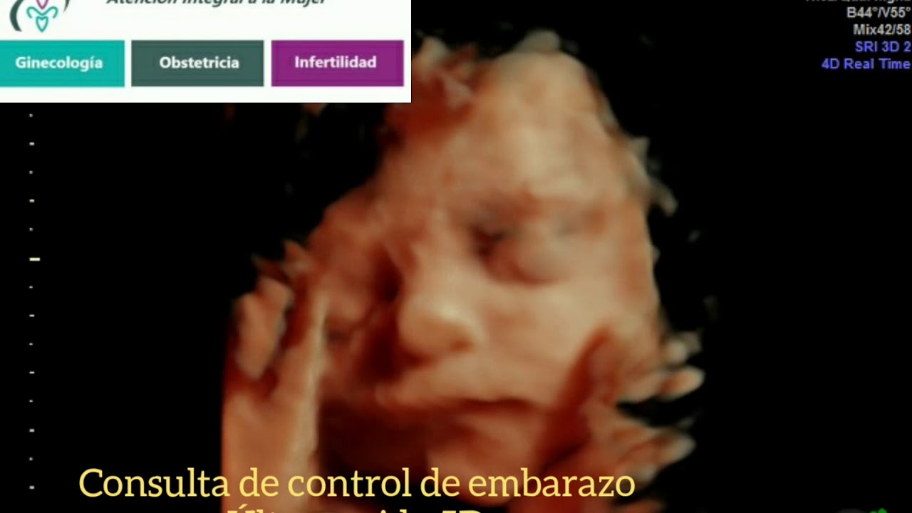 Alejandro Villaseñor Gonzalez-10