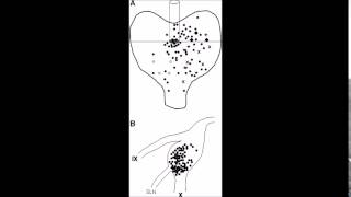 pulp - the trees (felled by i monster)