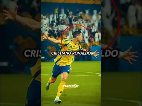 Why does Ronaldo wear a Bandage in his Wrist? 🤔🤕