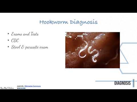 Pinworm vérszegénységek