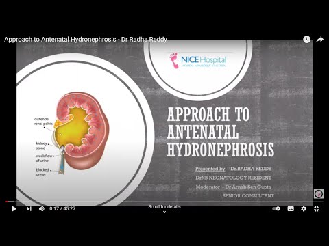 Approach to Antenatal Hydronephrosis - Dr Radha Reddy