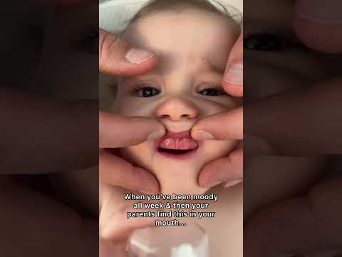 Baby teething problems 😭 #shorts