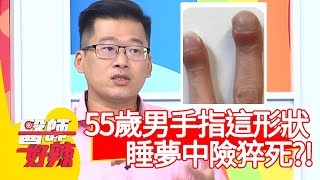 55歲男手指「這形狀」，睡夢中險猝死！醫：1小時呼吸中止65次！【醫師好辣】20200903 part4 EP1009 劉雨柔 宋晏仁