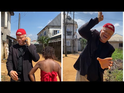 Albino can see the gods 😂😂😂