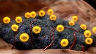 Special Report Killing Cancer VICE