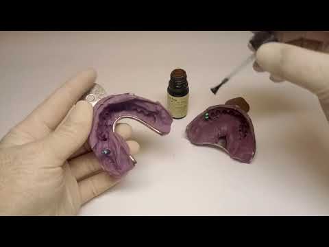 Zahntechnischer Workflow - Bicon: Teil 2 Modellherstellung