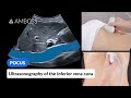 Point Of Care Ultrasound Of The Inferior Vena Cava IVC AMBOSS Video