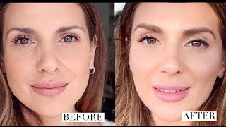HOW I GOT RID OF UNDER EYE HOLLOWS AND IMPROVED MY OVERALL LOOK |  ALI ANDREEA