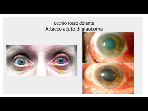 Recenzii de lero oftalmologice