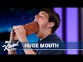 What Can This 16-Year-Old Fit in His Huge Mouth?