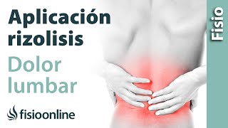 Cuándo aplicar Rizolisis en el  dolor lumbar crónico y Síndrome Facetario