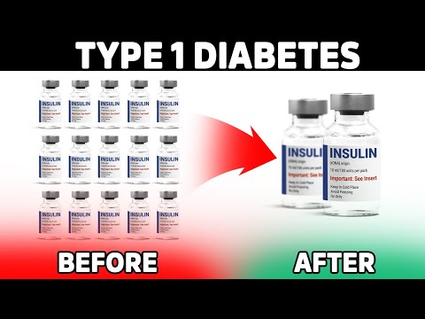 Does Stevia Affect your Blood Sugar – Dr Berg