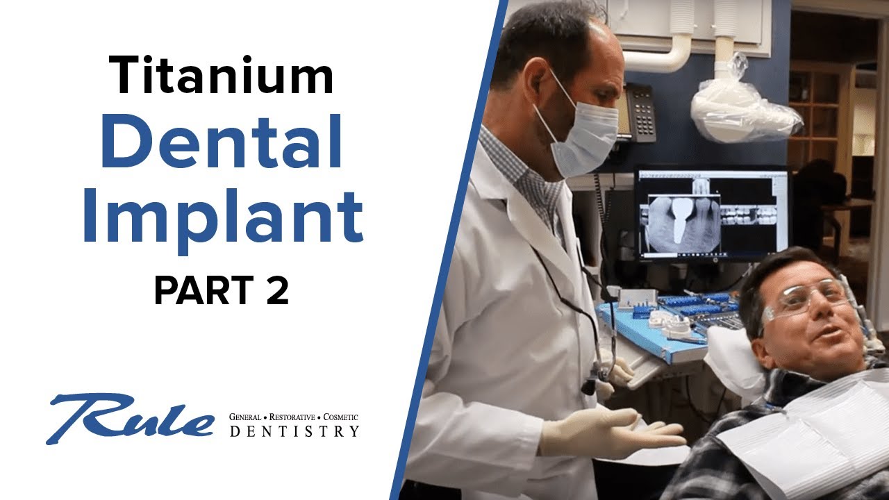 Placing a Crown on a Prepared Titanium Dental Implant — PART 2