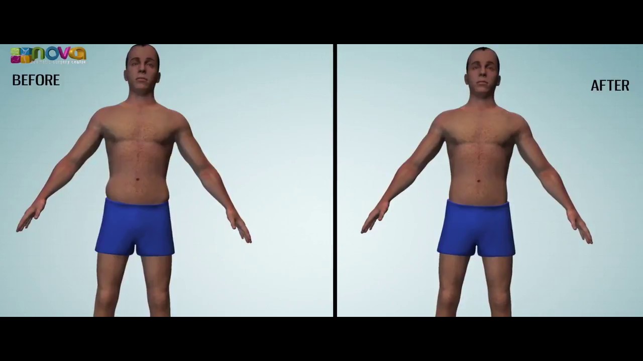 Best Medical Animation Videos | Nova | Medical & Healthcare Video Production Company