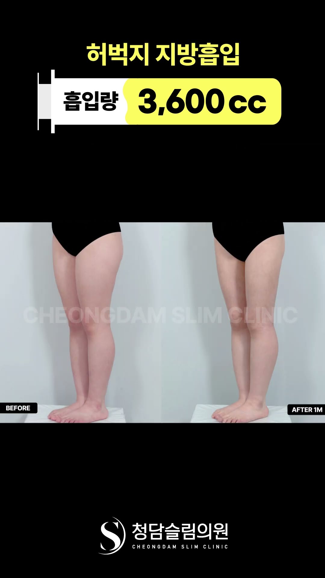 하체가 이렇게 매끈해질 수 있나..?