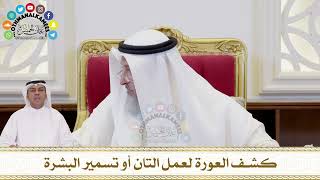 360 - كشف العورة لعمل التان أو تسمير البشرة - عثمان الخميس