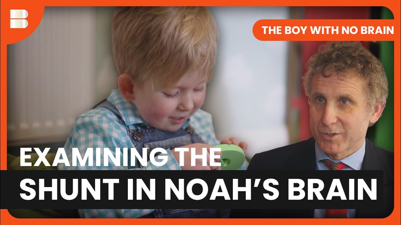A Shocking Turn | The Boy With No Brain | Medical Documentary