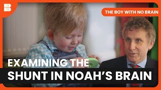 A Shocking Turn | The Boy With No Brain | Medical Documentary