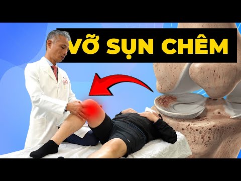 Vỡ Sụn Chêm Độ 3 CÓ BẮT BUỘC Phải Mổ? - Phương Pháp Điều Trị Bạn Cần Biết
