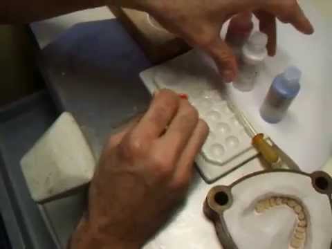 Colorazione flangia vestibolare con colori Candulor