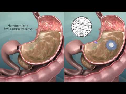 Degenerative dystrophischen Veränderungen in der Brustwirbelsäule Herzarrhythmien mit zervikaler Osteochondrose