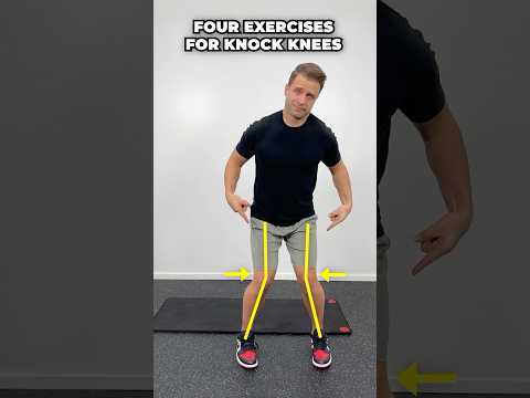 Fix Your Knock Knees! [4 Of The Best Home Exercises For Genu Valgus]