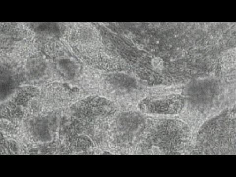 Das heilende Potenzial der menschlichen Zellen - science