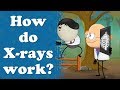 How Do X Rays Work Aumsum Kids Science Education Children
