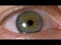 My Iris Wobbles! - Eye In Slow Motion 